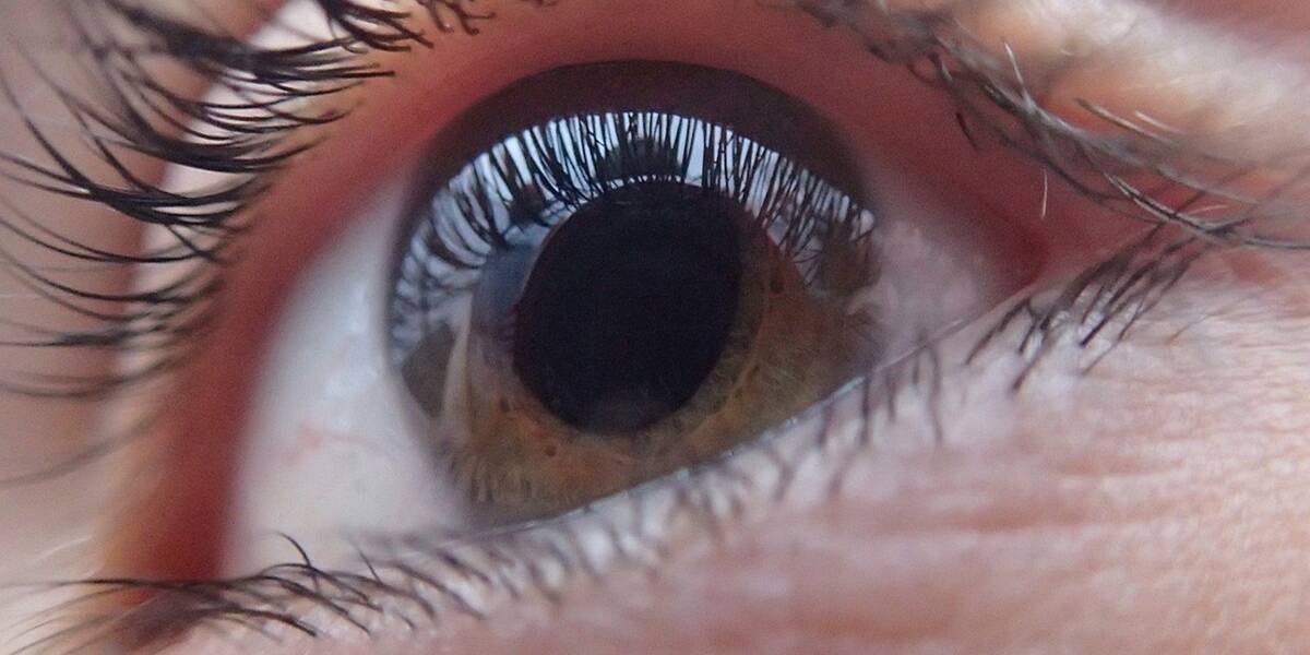 Szürkehályog-műtétek