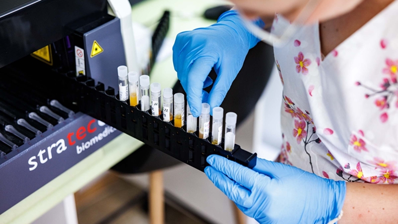 Forradalmi áttörés az Alzheimer-kór korai felismerésében