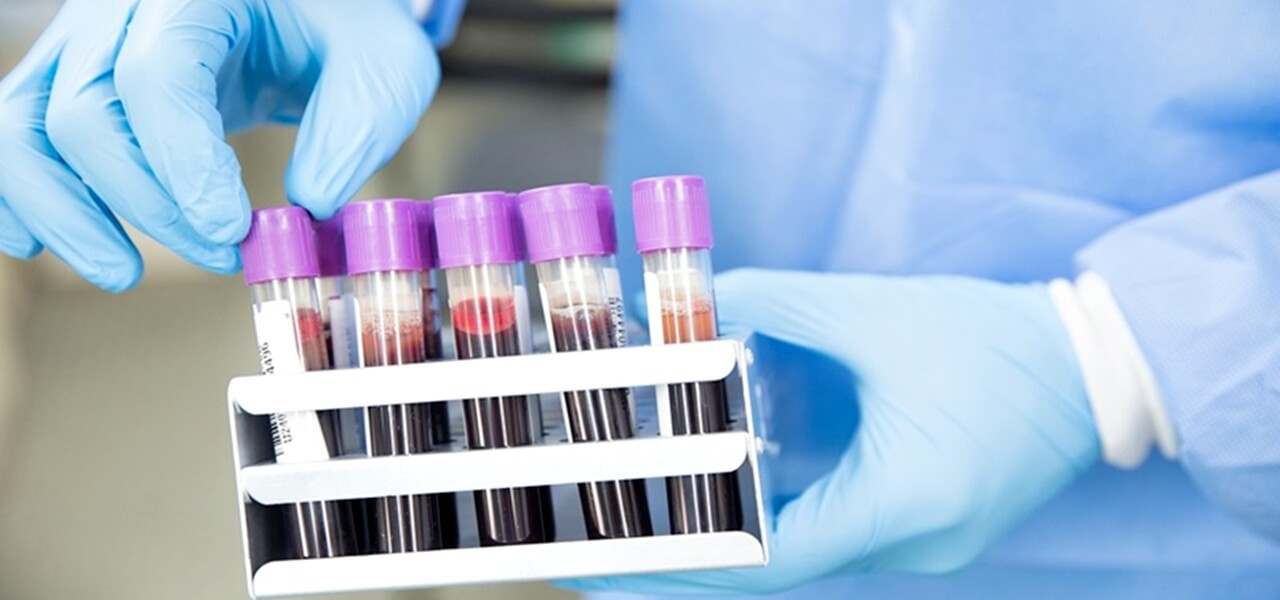 A vérplazma titkos ereje: így adhatod vissza másoknak az életet!